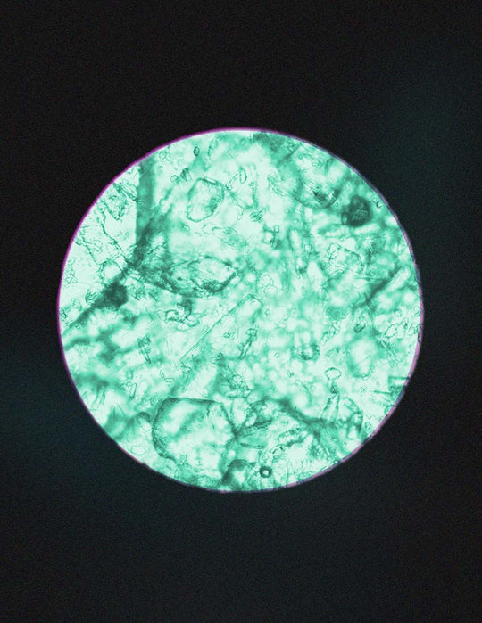 Zinc PCA